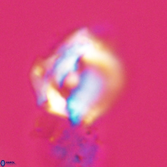 Helicosphaerella robinsoniae VR 33140
