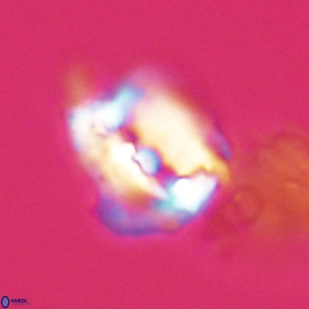 Helicosphaerella robinsoniae VR 33143