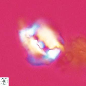 Helicosphaerella robinsoniae VR 33143