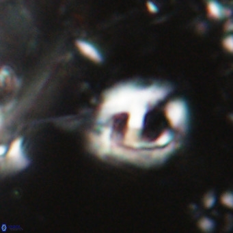 Helicosphaerella truncata VR 028580