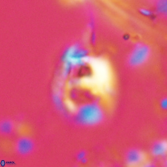 Helicosphaerella truncata VR 028582