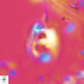 Helicosphaerella truncata VR 028582