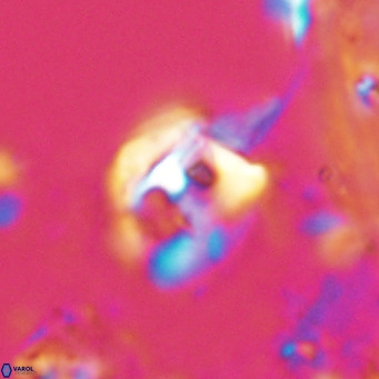 Helicosphaerella truncata VR 028585