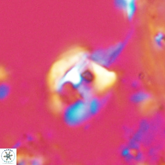 Helicosphaerella truncata VR 028585