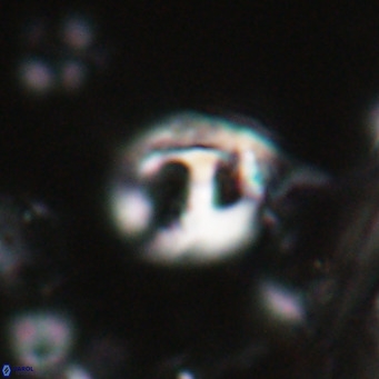 Helicosphaerella truncata VR 028587