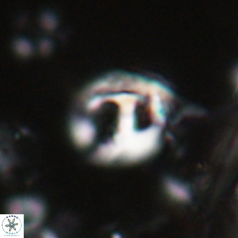 Helicosphaerella truncata VR 028587