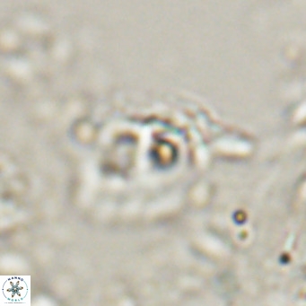Helicosphaerella truncata VR 028589