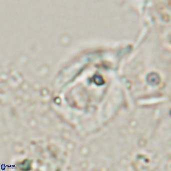 Helicosphaerella truncata VR 028590