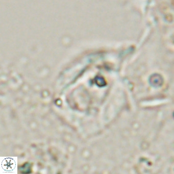 Helicosphaerella truncata VR 028590