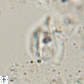 Helicosphaerella truncata VR 028592