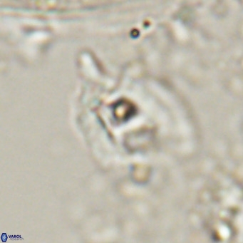 Helicosphaerella truncata VR 028593