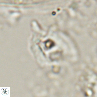 Helicosphaerella truncata VR 028593