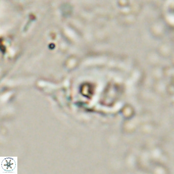 Helicosphaerella truncata VR 028595