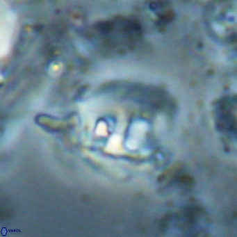 Helicosphaerella truncata VR 028596