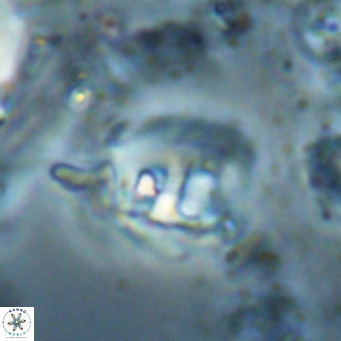 Helicosphaerella truncata VR 028596