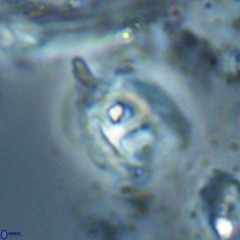 Helicosphaerella truncata VR 028597