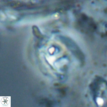 Helicosphaerella truncata VR 028597