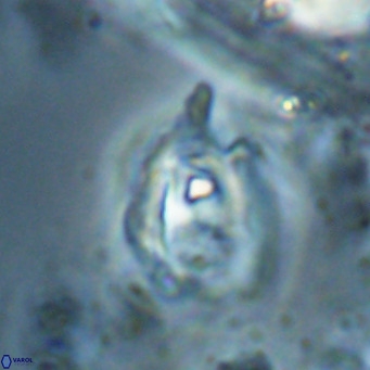 Helicosphaerella truncata VR 028599