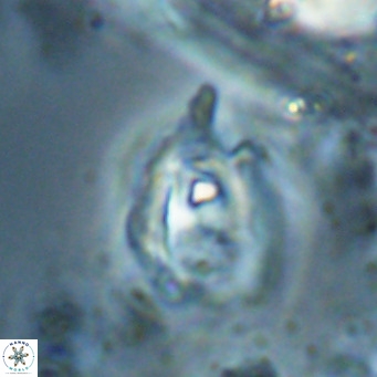 Helicosphaerella truncata VR 028599