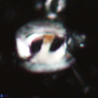 Helicosphaerella truncata VR 028640