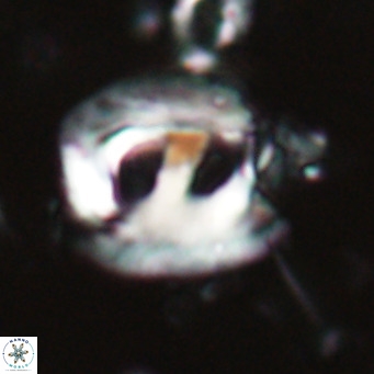 Helicosphaerella truncata VR 028640
