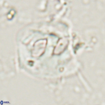 Helicosphaerella truncata VR 028641
