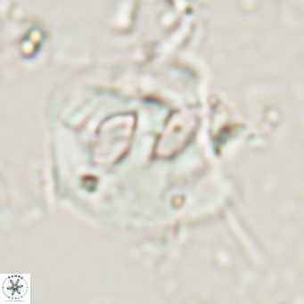 Helicosphaerella truncata VR 028641