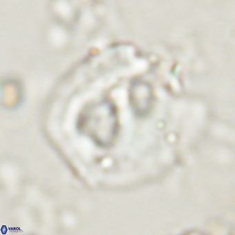 Helicosphaerella truncata VR 028642