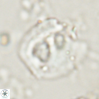 Helicosphaerella truncata VR 028642