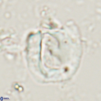 Helicosphaerella truncata VR 028643