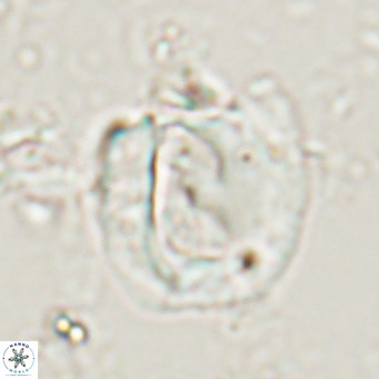 Helicosphaerella truncata VR 028643