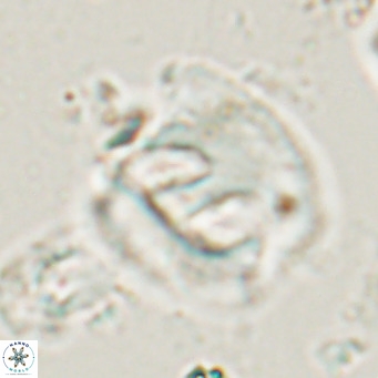 Helicosphaerella truncata VR 028644