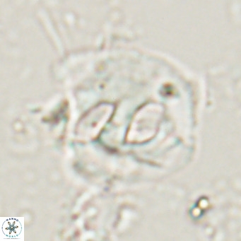 Helicosphaerella truncata VR 028645