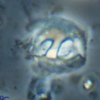 Helicosphaerella truncata VR 028646