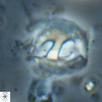 Helicosphaerella truncata VR 028646