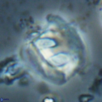 Helicosphaerella truncata VR 028647