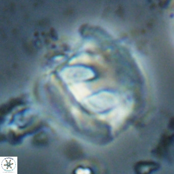Helicosphaerella truncata VR 028647