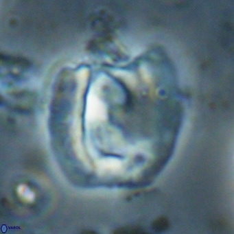 Helicosphaerella truncata VR 028648