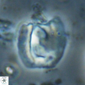 Helicosphaerella truncata VR 028648