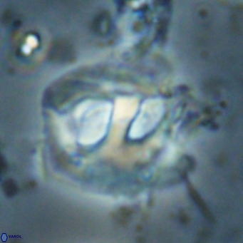 Helicosphaerella truncata VR 028650