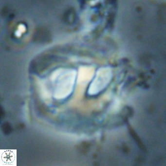 Helicosphaerella truncata VR 028650