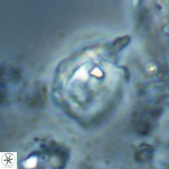 Helicosphaerella truncata VR 028600