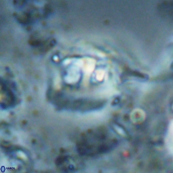 Helicosphaerella truncata VR 028601
