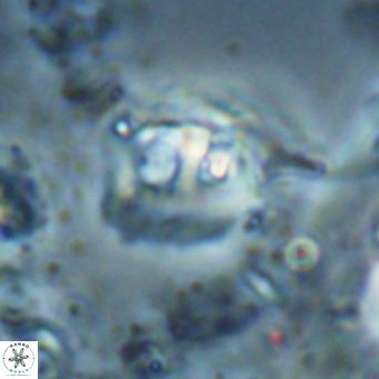 Helicosphaerella truncata VR 028601