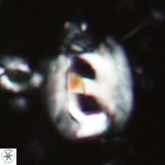 Helicosphaerella truncata VR 028632