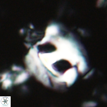 Helicosphaerella truncata VR 028633