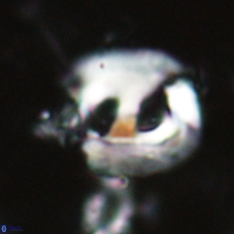 Helicosphaerella truncata VR 028636
