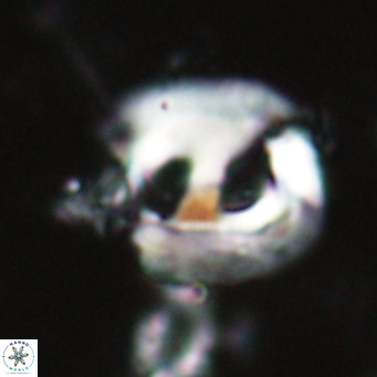 Helicosphaerella truncata VR 028636