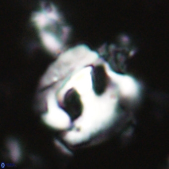 Helicosphaerella truncata VR 028637