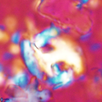 Helicosphaerella truncata VR 028840